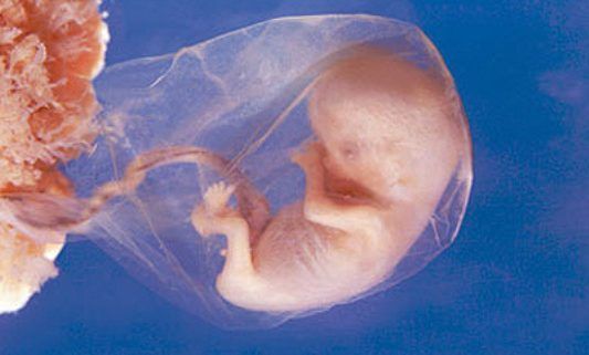 Mity protestujących zwolenniczek aborcji eugenicznej (analiza)